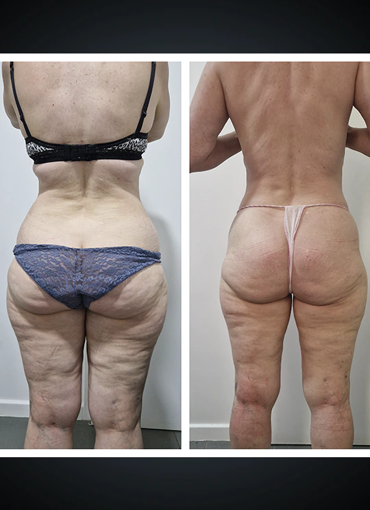 Criotonus_Resultado_21