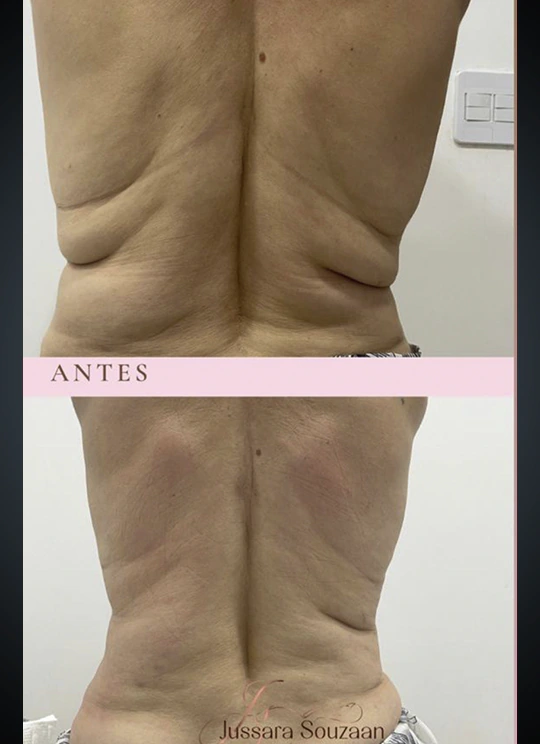Criotonus_Resultado_4
