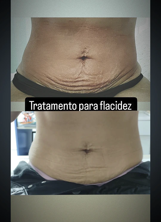 Criotonus_Resultado_7