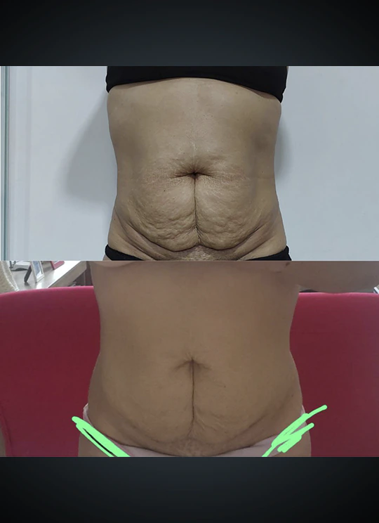 Criotonus_Resultado_2
